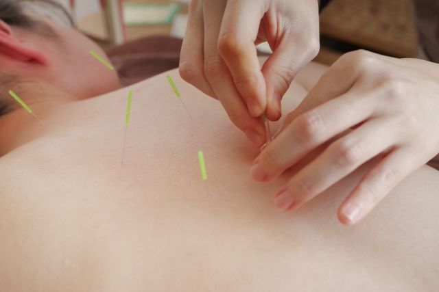 体の健康改善には鍼灸が効果的