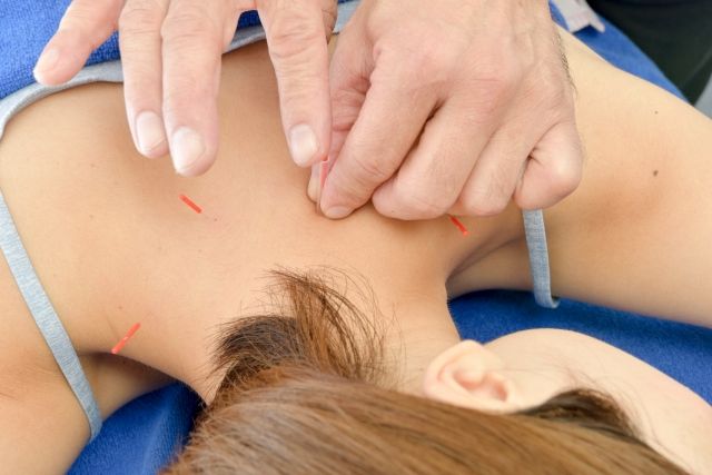 鍼灸が頭痛に効果的な理由